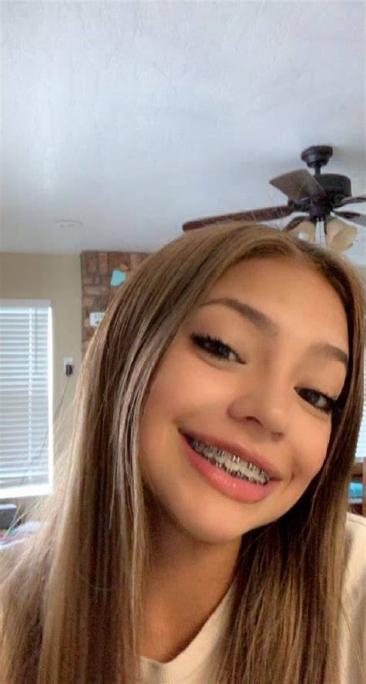 Skyleakss Braces Girl Leaked Viral Video Controversy