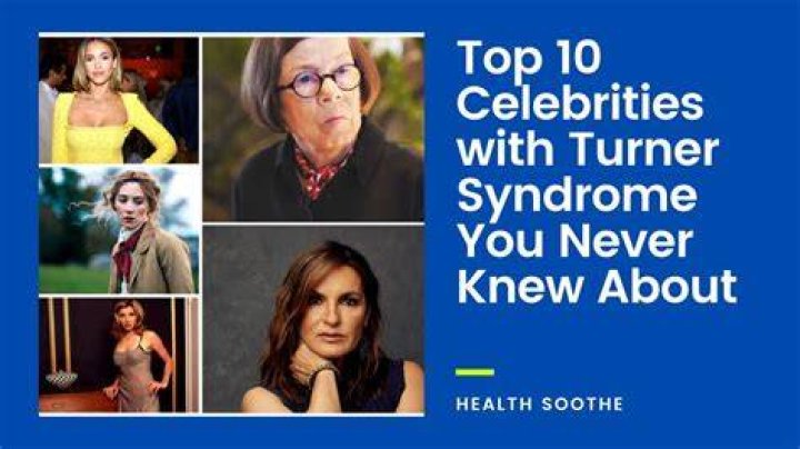 Top 10 Celebrities With Turner Syndrome You Could Never Think Of