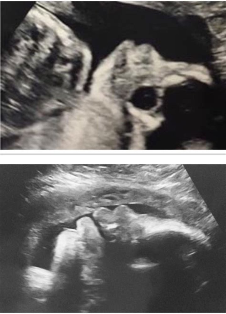 ultrasound (big lips) Glow Community