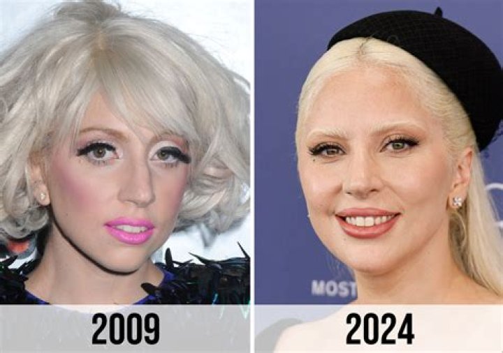 What Happened To Lady Gaga&rsquo;s Pregnancy Fans Think Lady Gaga Was