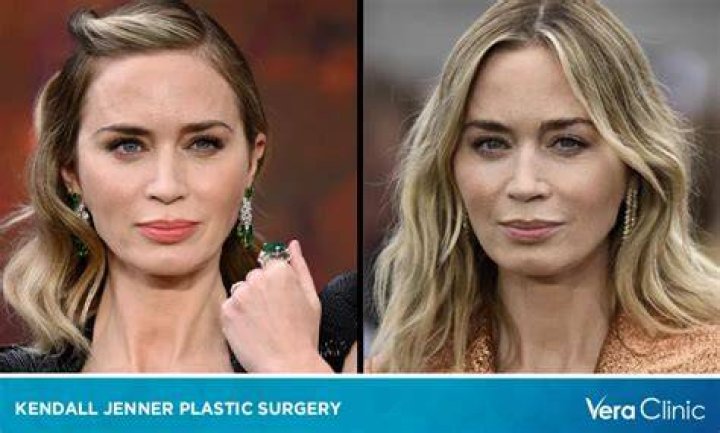 What Plastic Surgery Has Emily Swallow Gotten? Body Measurements and