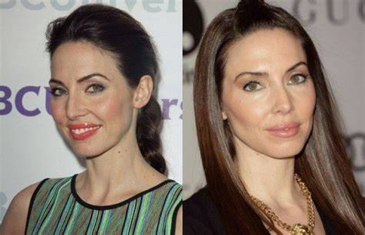 Whitney Cummings Plastic Surgery Everything You Should Know