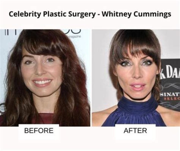 Whitney Cummings Plastic Surgery Is It Just A Weight Loss?