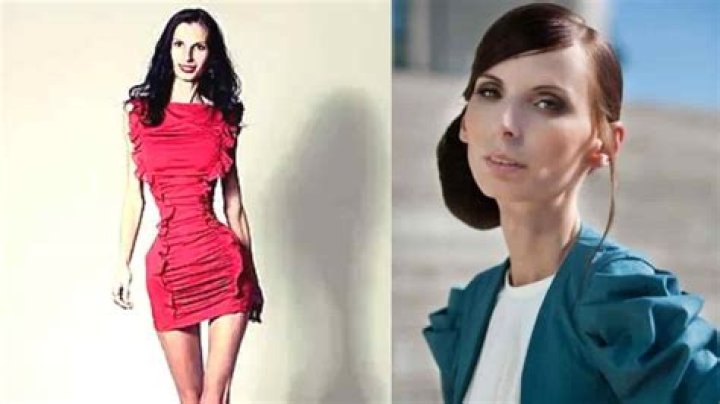 Who is the Skinniest Person in the World? Fashionterest