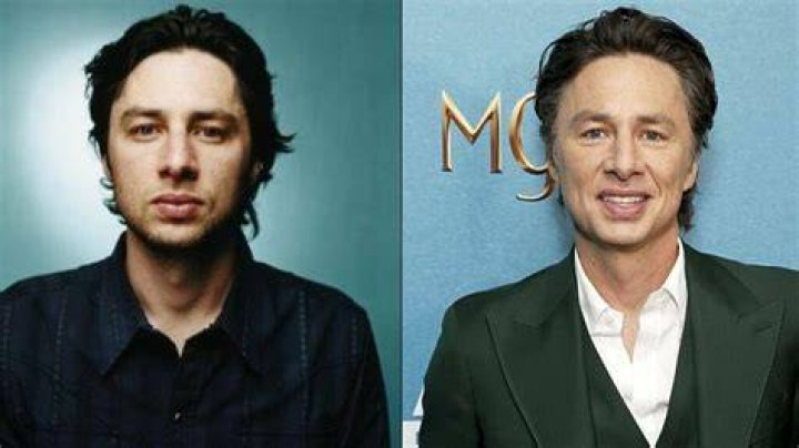 Zach Braff’s Plastic Surgery in 2022 What Happened to Him? Instagram